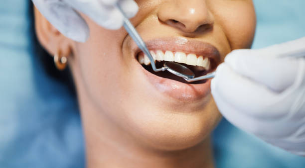 Best Emergency Broken Tooth Repair in De Pue, IL
